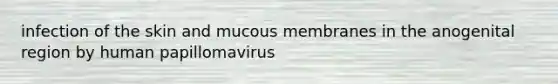 infection of the skin and mucous membranes in the anogenital region by human papillomavirus