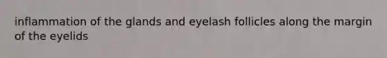 inflammation of the glands and eyelash follicles along the margin of the eyelids