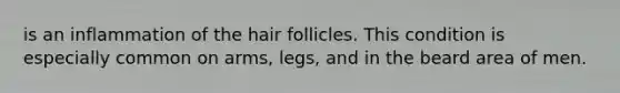 is an inflammation of the hair follicles. This condition is especially common on arms, legs, and in the beard area of men.