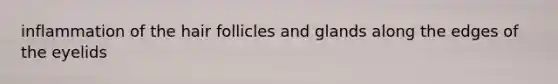 inflammation of the hair follicles and glands along the edges of the eyelids