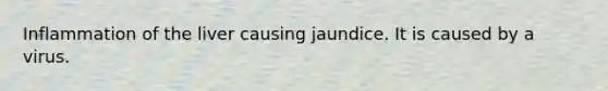 Inflammation of the liver causing jaundice. It is caused by a virus.