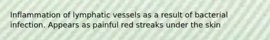 Inflammation of lymphatic vessels as a result of bacterial infection. Appears as painful red streaks under the skin