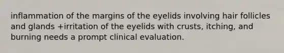 inflammation of the margins of the eyelids involving hair follicles and glands +irritation of the eyelids with crusts, itching, and burning needs a prompt clinical evaluation.