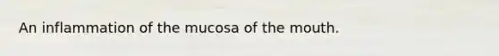 An inflammation of the mucosa of the mouth.