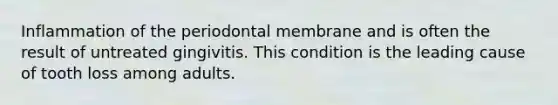 Inflammation of the periodontal membrane and is often the result of untreated gingivitis. This condition is the leading cause of tooth loss among adults.