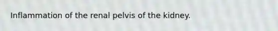 Inflammation of the renal pelvis of the kidney.