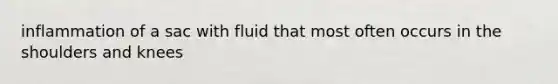 inflammation of a sac with fluid that most often occurs in the shoulders and knees