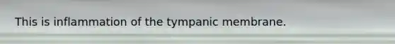 This is inflammation of the tympanic membrane.