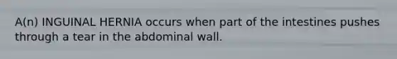 A(n) INGUINAL HERNIA occurs when part of the intestines pushes through a tear in the abdominal wall.