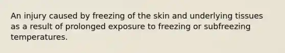 An injury caused by freezing of the skin and underlying tissues as a result of prolonged exposure to freezing or subfreezing temperatures.