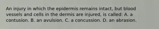 An injury in which the epidermis remains​ intact, but blood vessels and cells in the dermis are​ injured, is​ called: A. a contusion. B. an avulsion. C. a concussion. D. an abrasion.