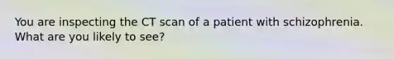 You are inspecting the CT scan of a patient with schizophrenia. What are you likely to see?