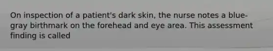 On inspection of a patient's dark skin, the nurse notes a blue-gray birthmark on the forehead and eye area. This assessment finding is called