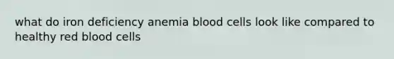 what do iron deficiency anemia blood cells look like compared to healthy red blood cells