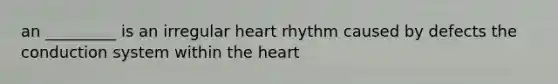 an _________ is an irregular heart rhythm caused by defects the conduction system within the heart