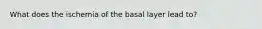 What does the ischemia of the basal layer lead to?