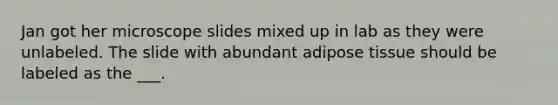 Jan got her microscope slides mixed up in lab as they were unlabeled. The slide with abundant adipose tissue should be labeled as the ___.