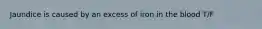 Jaundice is caused by an excess of iron in the blood T/F