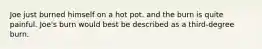 Joe just burned himself on a hot pot. and the burn is quite painful. Joe's burn would best be described as a third-degree burn.