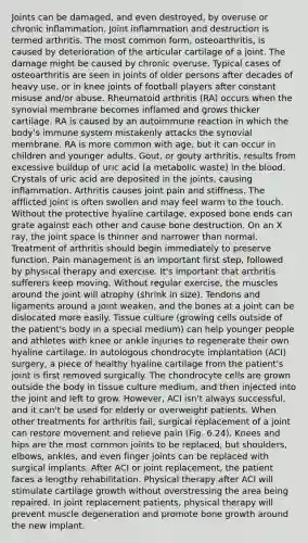 Joints can be damaged, and even destroyed, by overuse or chronic inflammation. Joint inflammation and destruction is termed arthritis. The most common form, osteoarthritis, is caused by deterioration of the articular cartilage of a joint. The damage might be caused by chronic overuse. Typical cases of osteoarthritis are seen in joints of older persons after decades of heavy use, or in knee joints of football players after constant misuse and/or abuse. Rheumatoid arthritis (RA) occurs when the synovial membrane becomes inflamed and grows thicker cartilage. RA is caused by an autoimmune reaction in which the body's immune system mistakenly attacks the synovial membrane. RA is more common with age, but it can occur in children and younger adults. Gout, or gouty arthritis, results from excessive buildup of uric acid (a metabolic waste) in <a href='https://www.questionai.com/knowledge/k7oXMfj7lk-the-blood' class='anchor-knowledge'>the blood</a>. Crystals of uric acid are deposited in the joints, causing inflammation. Arthritis causes joint pain and stiffness. The afflicted joint is often swollen and may feel warm to the touch. Without the protective hyaline cartilage, exposed bone ends can grate against each other and cause bone destruction. On an X ray, the joint space is thinner and narrower than normal. Treatment of arthritis should begin immediately to preserve function. Pain management is an important first step, followed by physical therapy and exercise. It's important that arthritis sufferers keep moving. Without regular exercise, the muscles around the joint will atrophy (shrink in size). Tendons and ligaments around a joint weaken, and the bones at a joint can be dislocated more easily. Tissue culture (growing cells outside of the patient's body in a special medium) can help younger people and athletes with knee or ankle injuries to regenerate their own hyaline cartilage. In autologous chondrocyte implantation (ACI) surgery, a piece of healthy hyaline cartilage from the patient's joint is first removed surgically. The chondrocyte cells are grown outside the body in tissue culture medium, and then injected into the joint and left to grow. However, ACI isn't always successful, and it can't be used for elderly or overweight patients. When other treatments for arthritis fail, surgical replacement of a joint can restore movement and relieve pain (Fig. 6.24). Knees and hips are the most common joints to be replaced, but shoulders, elbows, ankles, and even finger joints can be replaced with surgical implants. After ACI or joint replacement, the patient faces a lengthy rehabilitation. Physical therapy after ACI will stimulate cartilage growth without overstressing the area being repaired. In joint replacement patients, physical therapy will prevent muscle degeneration and promote <a href='https://www.questionai.com/knowledge/ki4t7AlC39-bone-growth' class='anchor-knowledge'>bone growth</a> around the new implant.