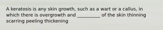 A keratosis is any skin growth, such as a wart or a callus, in which there is overgrowth and __________ of the skin thinning scarring peeling thickening