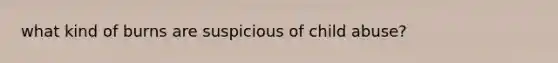 what kind of burns are suspicious of child abuse?