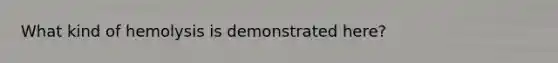 What kind of hemolysis is demonstrated here?