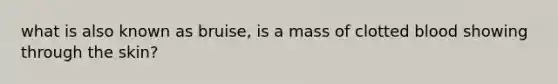 what is also known as bruise, is a mass of clotted blood showing through the skin?