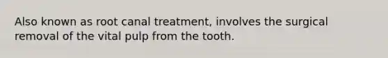 Also known as root canal treatment, involves the surgical removal of the vital pulp from the tooth.