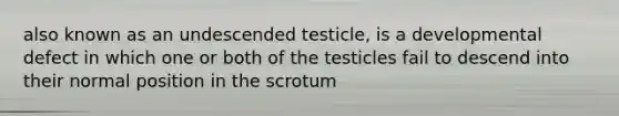 also known as an undescended testicle, is a developmental defect in which one or both of the testicles fail to descend into their normal position in the scrotum