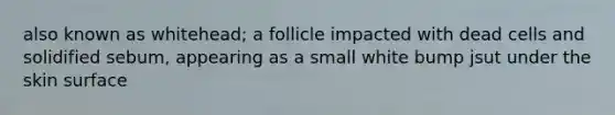 also known as whitehead; a follicle impacted with dead cells and solidified sebum, appearing as a small white bump jsut under the skin surface