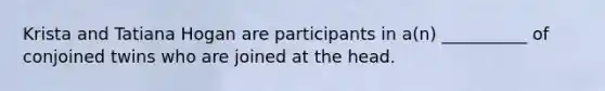 Krista and Tatiana Hogan are participants in a(n) __________ of conjoined twins who are joined at the head.