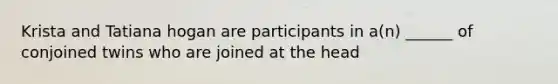 Krista and Tatiana hogan are participants in a(n) ______ of conjoined twins who are joined at the head