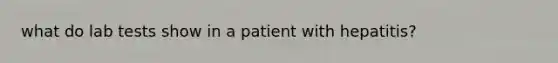 what do lab tests show in a patient with hepatitis?