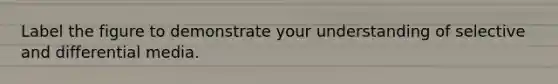 Label the figure to demonstrate your understanding of selective and differential media.