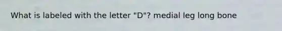 What is labeled with the letter "D"? medial leg long bone