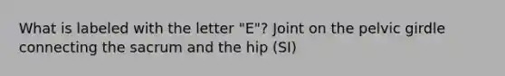 What is labeled with the letter "E"? Joint on the pelvic girdle connecting the sacrum and the hip (SI)