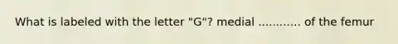 What is labeled with the letter "G"? medial ............ of the femur