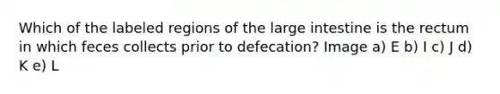 Which of the labeled regions of the large intestine is the rectum in which feces collects prior to defecation? Image a) E b) I c) J d) K e) L