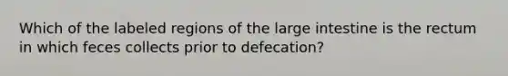 Which of the labeled regions of the large intestine is the rectum in which feces collects prior to defecation?