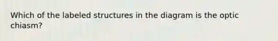 Which of the labeled structures in the diagram is the optic chiasm?