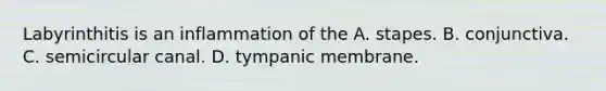 Labyrinthitis is an inflammation of the A. stapes. B. conjunctiva. C. semicircular canal. D. tympanic membrane.