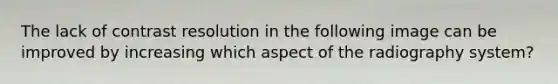 The lack of contrast resolution in the following image can be improved by increasing which aspect of the radiography system?