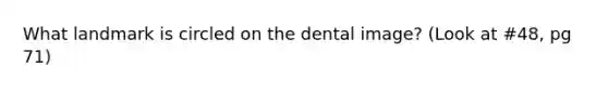 What landmark is circled on the dental image? (Look at #48, pg 71)