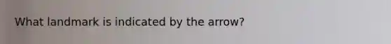 What landmark is indicated by the arrow?