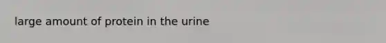 large amount of protein in the urine