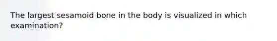 The largest sesamoid bone in the body is visualized in which examination?