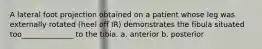 A lateral foot projection obtained on a patient whose leg was externally rotated (heel off IR) demonstrates the fibula situated too______________ to the tibia. a. anterior b. posterior