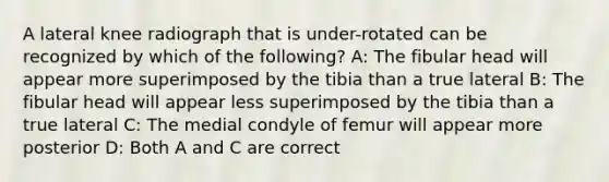 A lateral knee radiograph that is under-rotated can be recognized by which of the following? A: The fibular head will appear more superimposed by the tibia than a true lateral B: The fibular head will appear less superimposed by the tibia than a true lateral C: The medial condyle of femur will appear more posterior D: Both A and C are correct