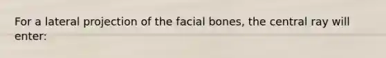 For a lateral projection of the facial bones, the central ray will enter: